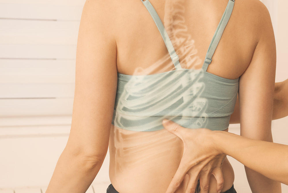 Skoliosetherapie nach Schroth